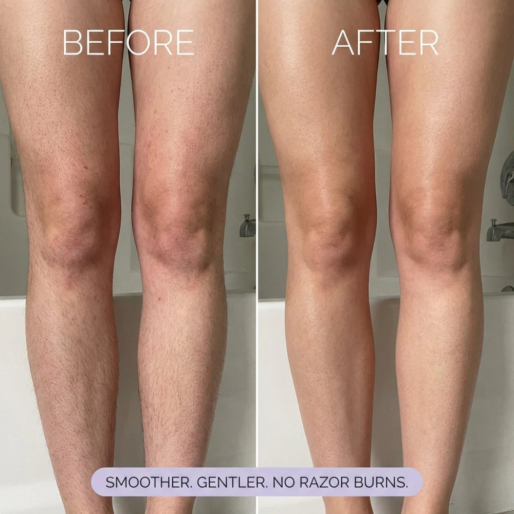 Wellora Hair Removal Spray
