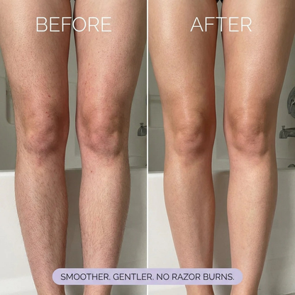 Wellora Hair Removal Spray
