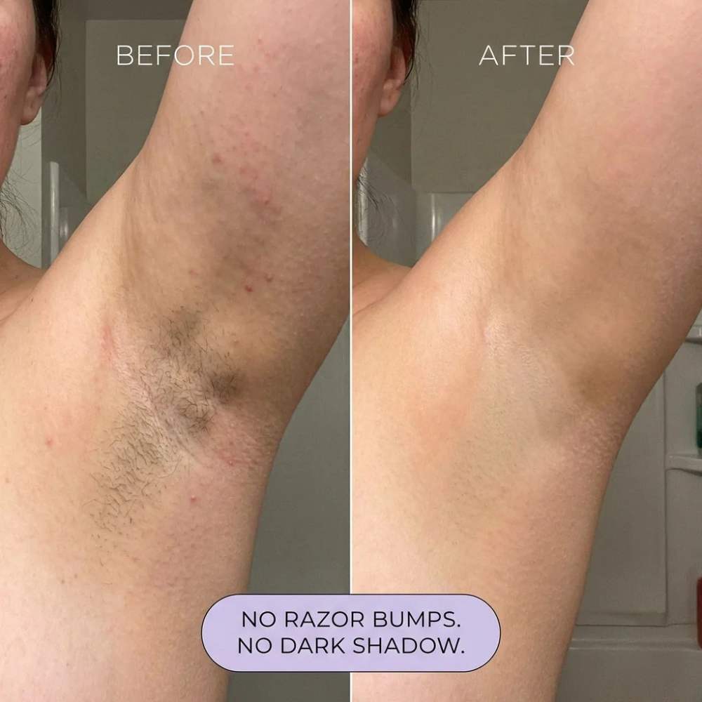 Wellora Hair Removal Spray